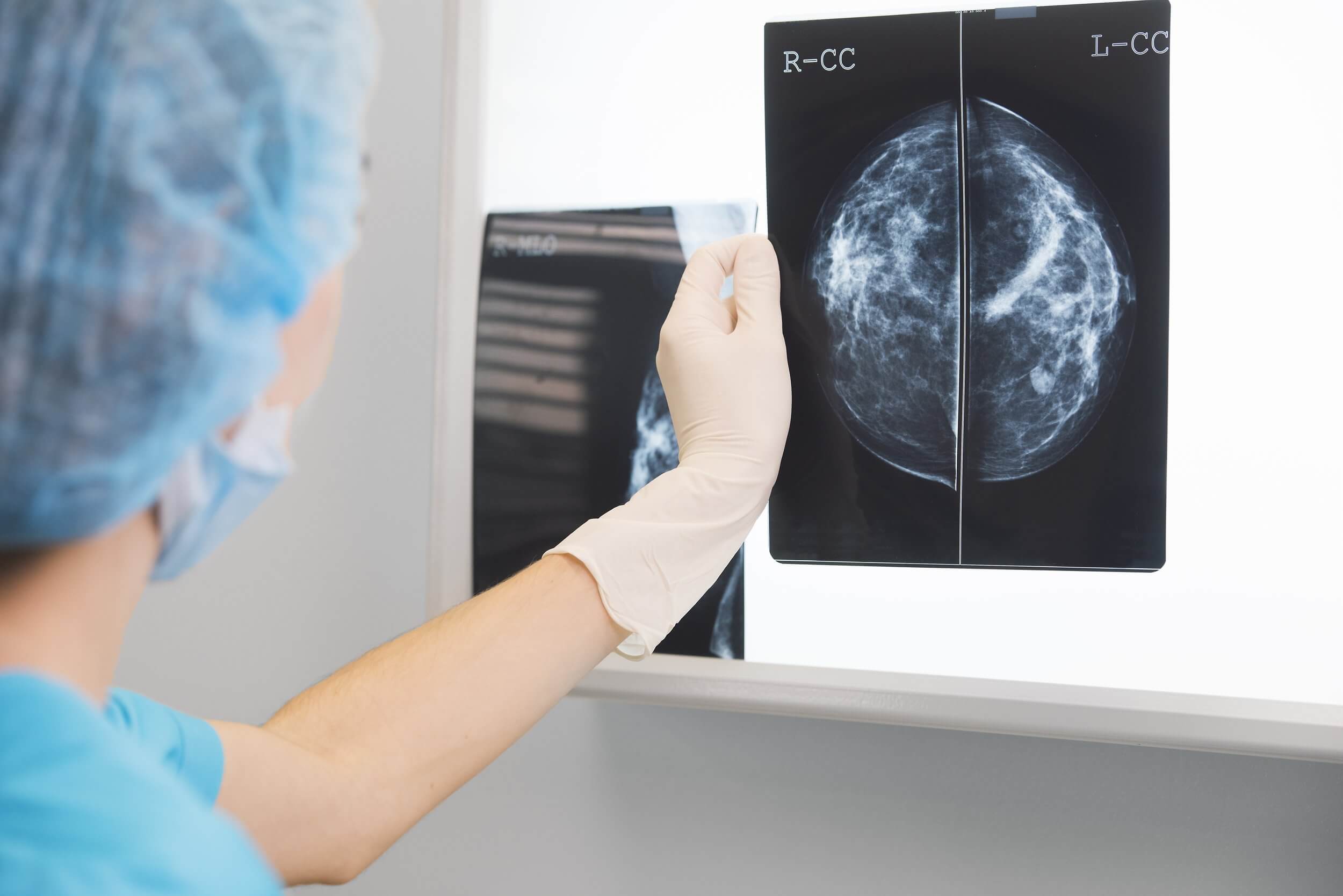 3D Mammogram results