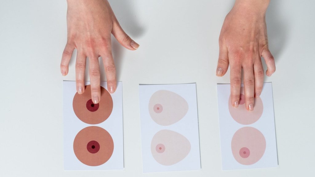 What Do Dense Breasts Have to Do with Breast Cancer?