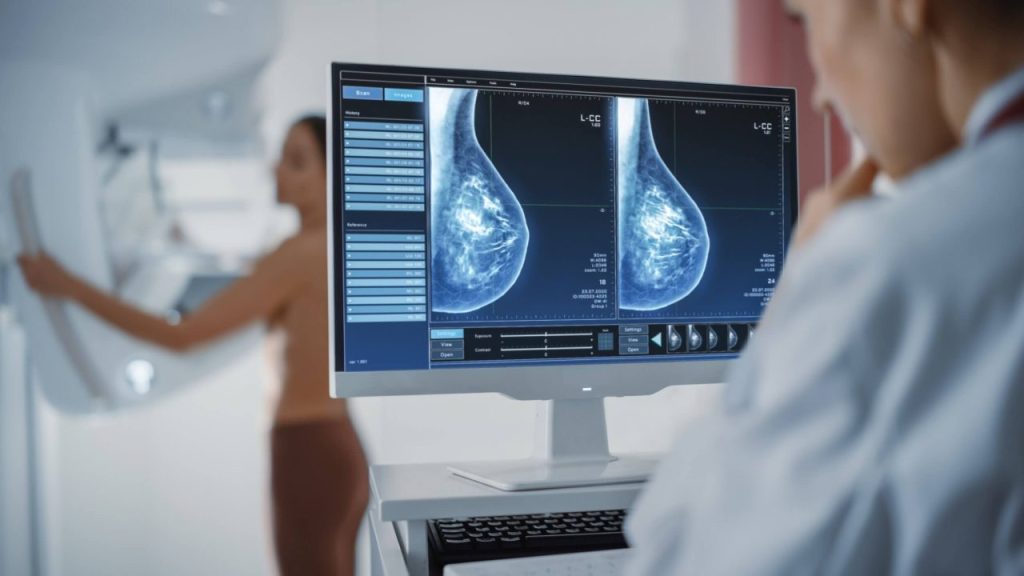 What Does My Abnormal Mammogram Result Mean?